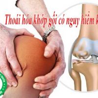 Chữa Thoái Hóa Khớp Gối Theo Y Học Cổ Truyền