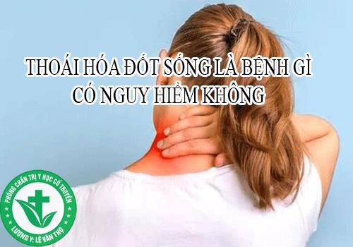 Những Nguy Hại Mà Bệnh Thoái Hóa Đốt Sống Gây Ra